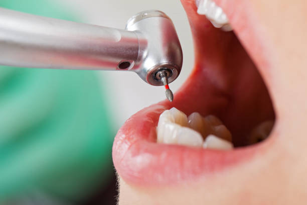 Best Pediatric Emergency Dentist in Bolindale, OH